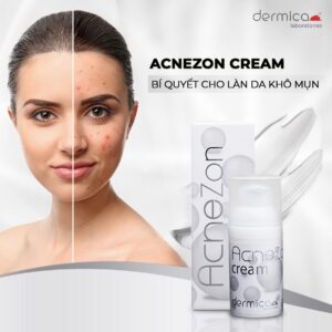 AcneZon Cream