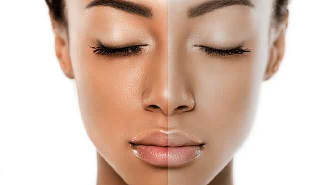 Ngăn hình thành sắc tố melanin là cách làm sáng da mặt hiệu quả