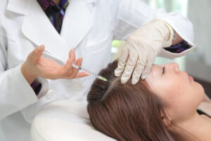 Có gì “đặc biệt” khi tiêm meso điều trị rụng tóc? 
