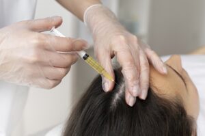 Chống chỉ định của mesotherapy điều trị rụng tóc, kích thích mọc tóc